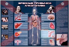 Электрифицированный стенд "Вредные привычки: алкоголизм" - fgospostavki.ru - Калуга