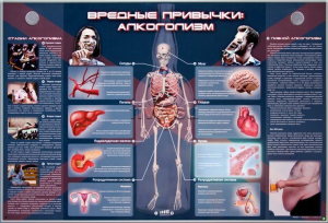 Электрифицированный стенд "Вредные привычки: алкоголизм" - fgospostavki.ru - Калуга